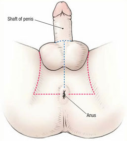 Wat is het perineum?